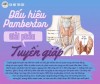 (Sổ tay y khoa) - "Dấu hiệu Pamberton"