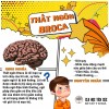 (Sổ tay y khoa) - "Thất ngôn Broca"