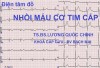 Dien tam do ECG 4