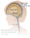 HỘI CHỨNG MÀNG NÃO