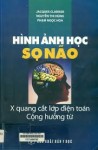 hình ảnh học sọ não