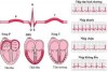 RỐI LOẠN CHỨC NĂNG TRONG BỆNH TIM