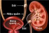 NHỮNG RỐI LOẠN CHỨC NĂNG CỦA HỆ THỐNG THẬN - TIẾT NIỆU