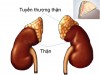 TRIỆU CHỨNG HỌC TUYẾN THƯỢNG THẬN