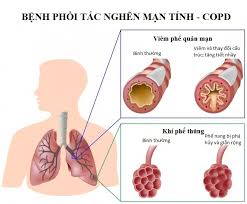tải xuống (1)