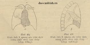tràn