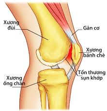 KLS KHỚP